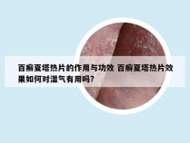 百癣夏塔热片的作用与功效 百癣夏塔热片效果如何对湿气有用吗?