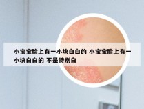 小宝宝脸上有一小块白白的 小宝宝脸上有一小块白白的 不是特别白