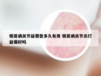 银屑病关节益赛普多久有用 银屑病关节炎打益赛好吗