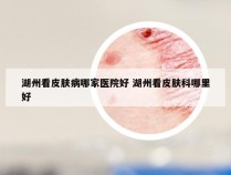 湖州看皮肤病哪家医院好 湖州看皮肤科哪里好