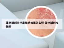 生物制剂治疗皮肤病效果怎么样 生物制剂皮肤科