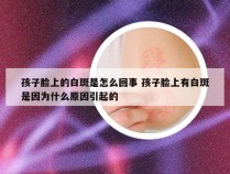 孩子脸上的白斑是怎么回事 孩子脸上有白斑是因为什么原因引起的