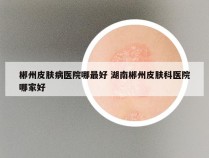 郴州皮肤病医院哪最好 湖南郴州皮肤科医院哪家好