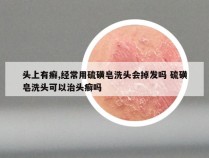 头上有癣,经常用硫磺皂洗头会掉发吗 硫磺皂洗头可以治头癣吗