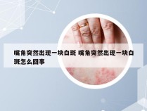 嘴角突然出现一块白斑 嘴角突然出现一块白斑怎么回事