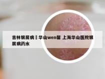 吉林银屑病來华山wen馨 上海华山医院银屑病药水