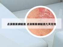 点滴银屑病输液 点滴银屑病输液几天见效