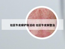 社区牛皮癣铲除活动 社区牛皮鲜整治