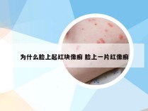 为什么脸上起红块像癣 脸上一片红像癣