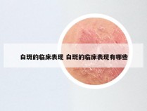 白斑的临床表现 白斑的临床表现有哪些