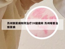 苏州银屑病如何治疗39健康网 苏州哪里治银屑病