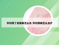 孕妇得了皮肤癣怎么办 孕妇得癣怎么治疗