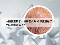 小孩蛋蛋长了一块癣怎么办 小孩蛋蛋起了一个红疙瘩怎么了?