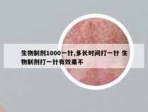 生物制剂1000一针,多长时间打一针 生物制剂打一针有效果不