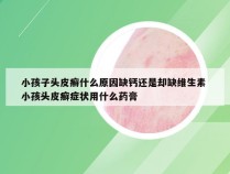 小孩子头皮癣什么原因缺钙还是却缺维生素 小孩头皮癣症状用什么药膏