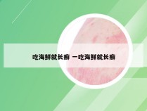 吃海鲜就长癣 一吃海鲜就长癣