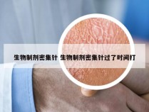 生物制剂密集针 生物制剂密集针过了时间打