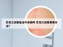 巴克三剑客能治牛皮癣吗 巴克三剑客使用方法?