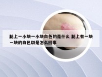 腿上一小块一小块白色的是什么 腿上有一块一块的白色斑是怎么回事