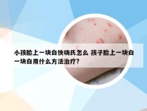 小孩脸上一块白快嗨氏怎么 孩子脸上一块白一块白用什么方法治疗?