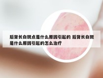 后背长白斑点是什么原因引起的 后背长白斑是什么原因引起的怎么治疗