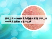 脖子上有一块皮肤发白是什么原因 脖子上有一小块皮肤长白了是什么病