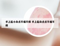 手上起小白点不痛不痒 手上起白点点不痛不痒