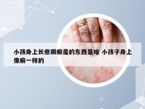 小孩身上长些跟癣是的东西是啥 小孩子身上像癣一样的