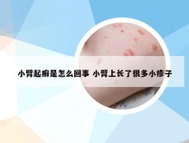 小臂起癣是怎么回事 小臂上长了很多小疹子