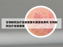 生物制剂治疗皮肤需要长期使用用吗 生物制剂治疗皮肤瘙痒