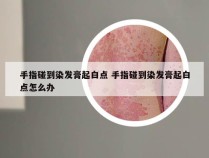 手指碰到染发膏起白点 手指碰到染发膏起白点怎么办