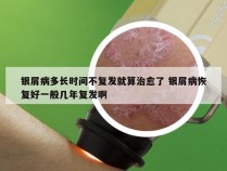 银屑病多长时间不复发就算治愈了 银屑病恢复好一般几年复发啊