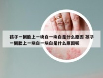 孩子一侧脸上一块白一块白是什么原因 孩子一侧脸上一块白一块白是什么原因呢