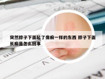 突然脖子下面起了像癣一样的东西 脖子下面长癣是怎么回事