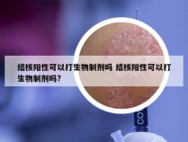 结核阳性可以打生物制剂吗 结核阳性可以打生物制剂吗?