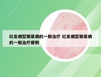 红皮病型银屑病的一般治疗 红皮病型银屑病的一般治疗原则