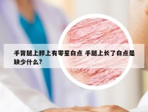 手背腿上脖上有零星白点 手腿上长了白点是缺少什么?