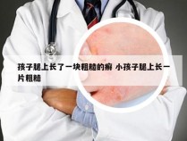 孩子腿上长了一块粗糙的癣 小孩子腿上长一片粗糙