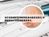 治疗皮肤病的生物制剂在体内能存活多久 生物制剂治疗皮肤病能维持多久