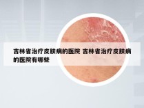 吉林省治疗皮肤病的医院 吉林省治疗皮肤病的医院有哪些