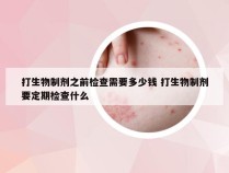 打生物制剂之前检查需要多少钱 打生物制剂要定期检查什么