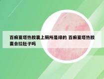 百癣夏塔热胶囊上厕所是绿的 百癣夏塔热胶囊会拉肚子吗