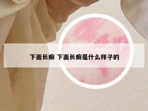 下面长癣 下面长癣是什么样子的