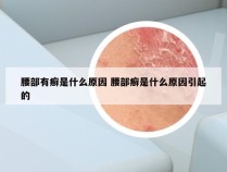 腰部有癣是什么原因 腰部癣是什么原因引起的