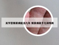 关节型银屑病能活几年 银屑病属于几级残疾