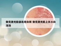 做完激光脸部出现白斑 做完激光脸上长小白泡泡