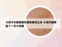 小孩子大腿根部长类似癣怎么办 小孩大腿根起了一片小疙瘩