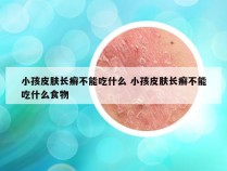 小孩皮肤长癣不能吃什么 小孩皮肤长癣不能吃什么食物