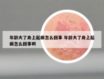 年龄大了身上起癣怎么回事 年龄大了身上起癣怎么回事啊