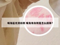 嘴角起光滑白斑 嘴角有白斑是怎么回事?